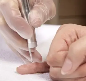 Pequenas Cirurgias Dermatológicas