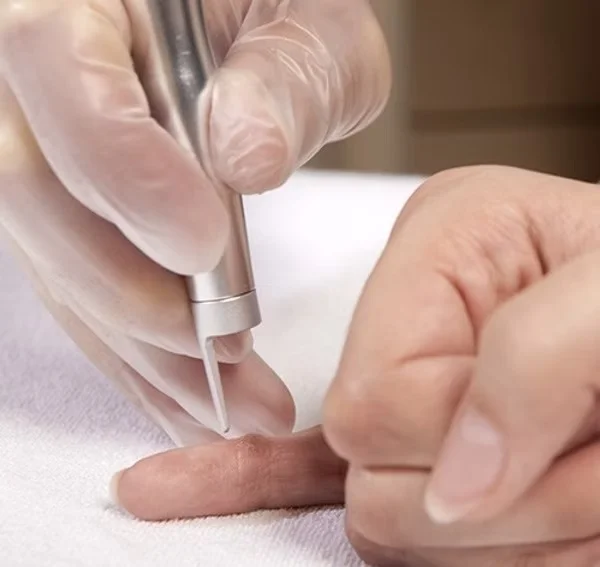 Pequenas Cirurgias Dermatológicas