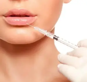 Preenchimento Labial