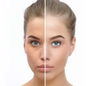 Skinbooster