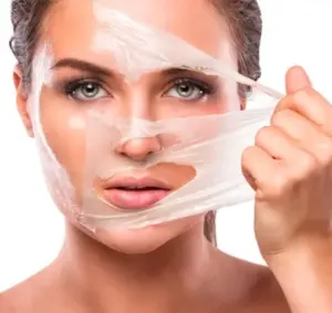 Peeling Químico